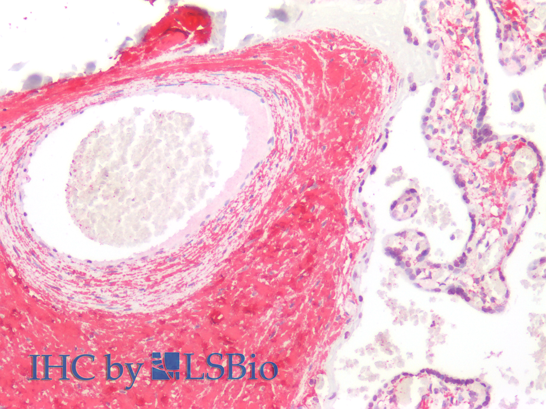 Monoclonal Antibody to Cross Linked C-Telopeptide Of Type I Collagen (CTXI)