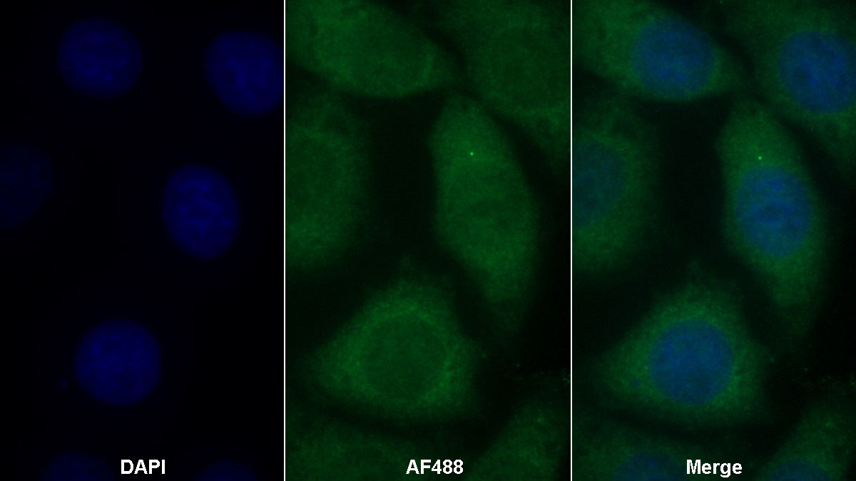 Monoclonal Antibody to Mucin 5 Subtype B (MUC5B)