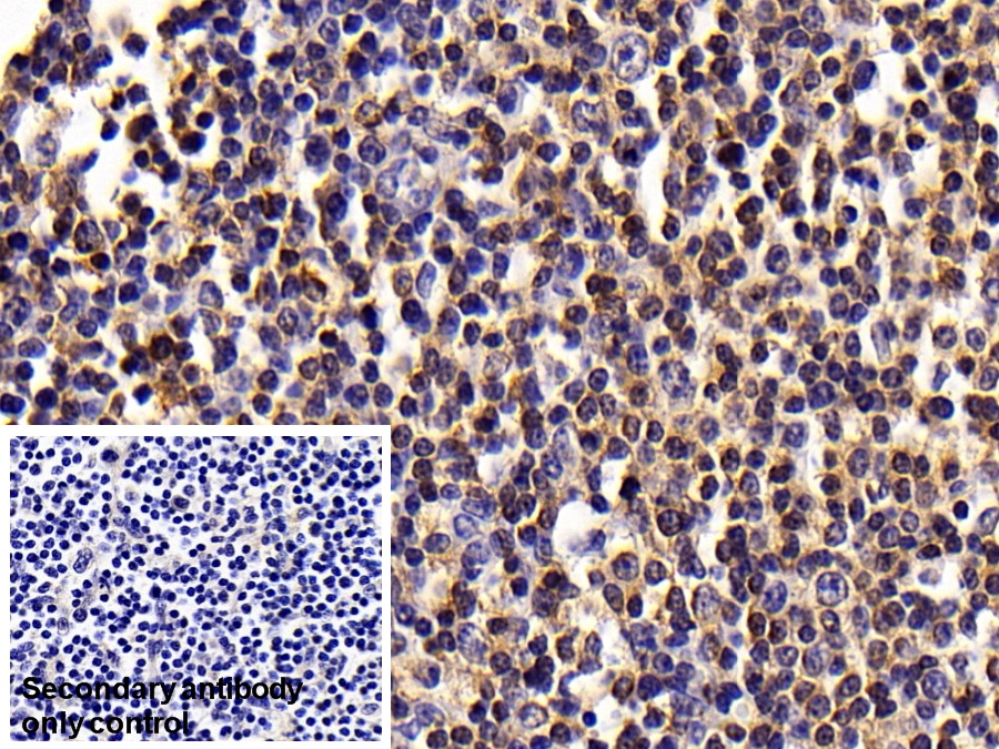 Monoclonal Antibody to Cluster Of Differentiation 14 (CD14)