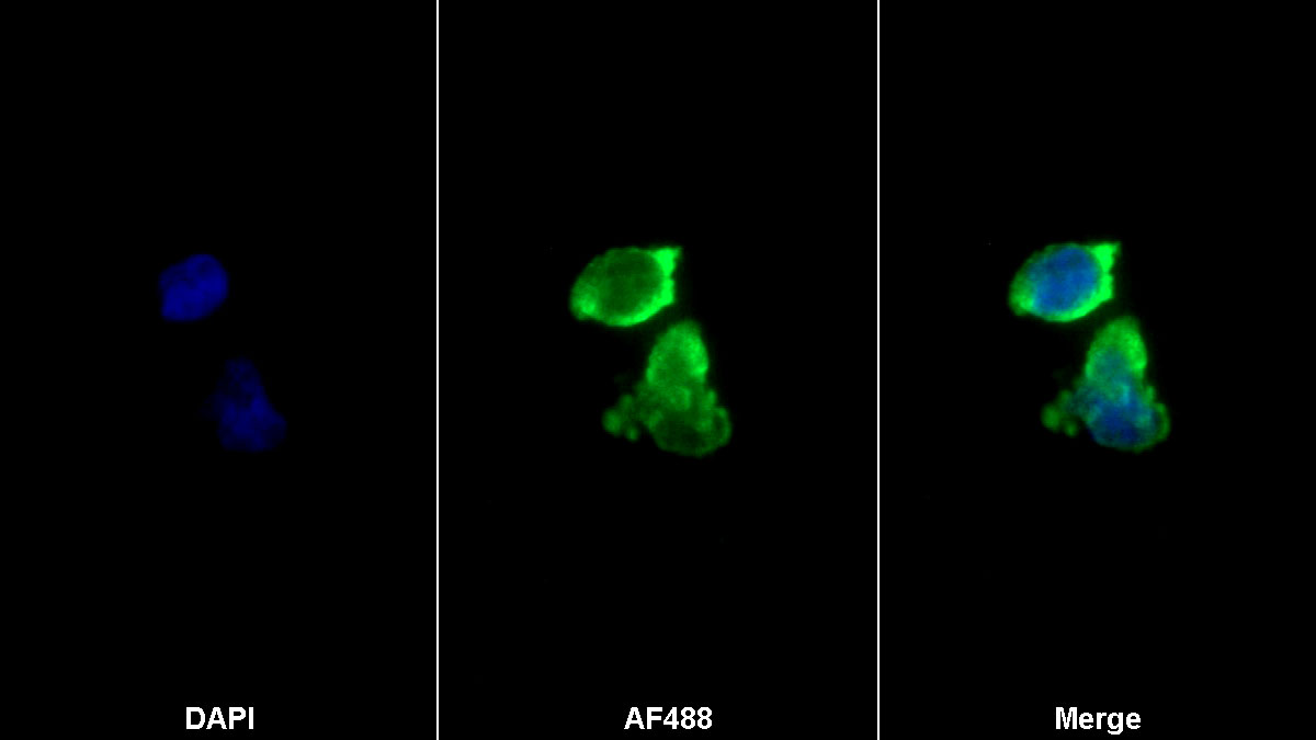 Monoclonal Antibody to Cluster Of Differentiation 14 (CD14)