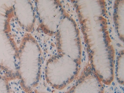 Monoclonal Antibody to Heat Shock Protein 27 (Hsp27)