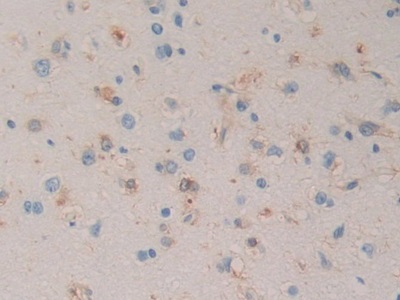 Monoclonal Antibody to Heat Shock Protein 27 (Hsp27)