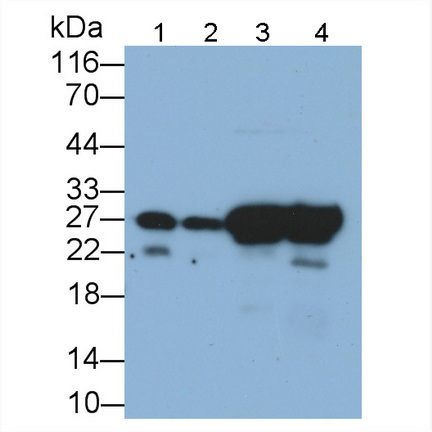 Monoclonal Antibody to Heat Shock Protein 27 (Hsp27)