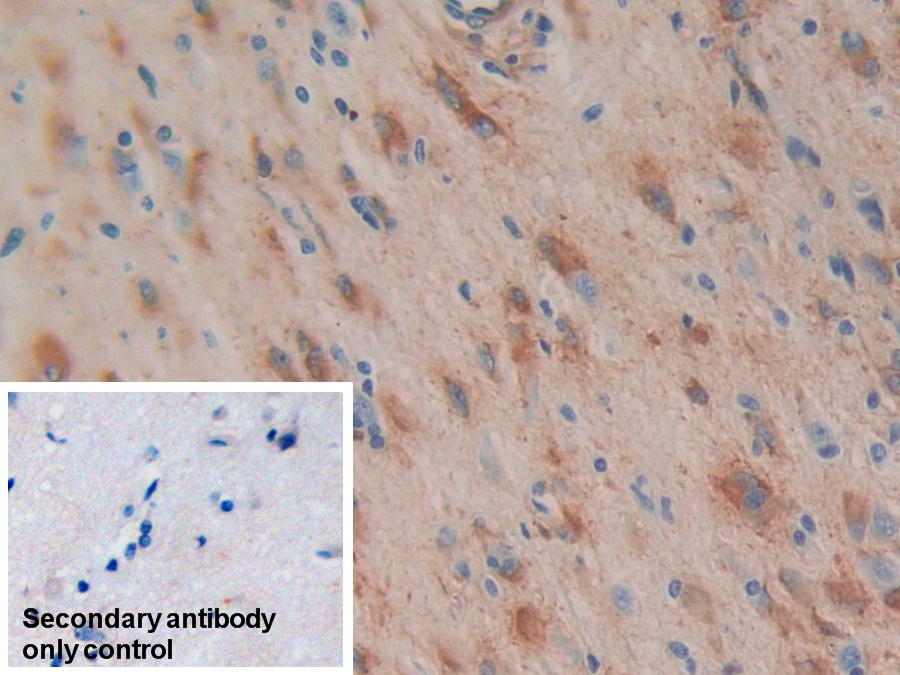 Monoclonal Antibody to Heat Shock Protein 27 (Hsp27)