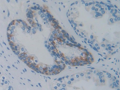 Monoclonal Antibody to Heat Shock Protein 27 (Hsp27)