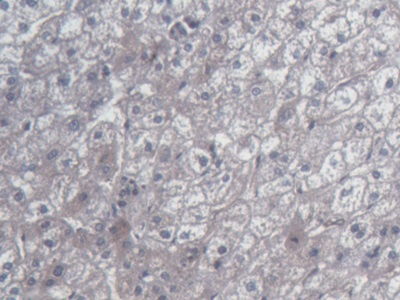 Monoclonal Antibody to Heat Shock Protein 27 (Hsp27)