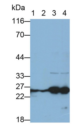 Monoclonal Antibody to Heat Shock Protein 27 (Hsp27)