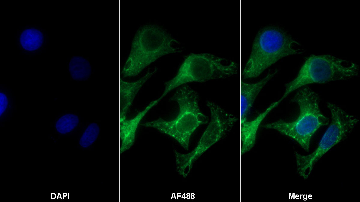 Monoclonal Antibody to Heat Shock Protein 27 (Hsp27)