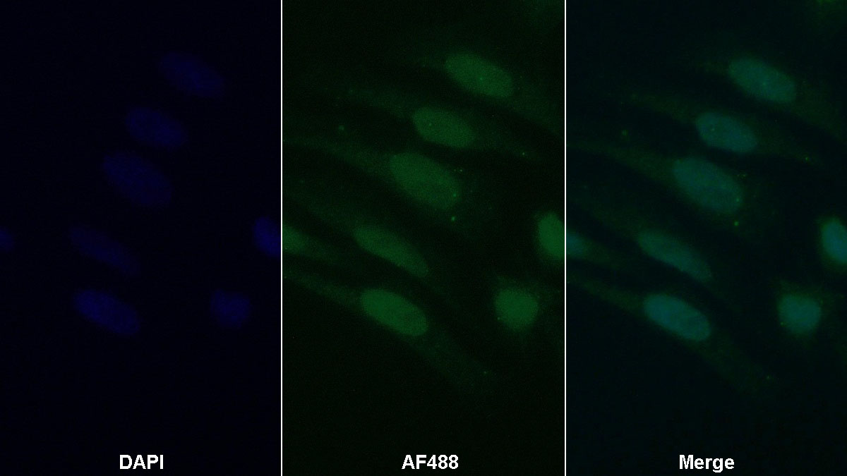 Monoclonal Antibody to Thioredoxin (Trx)