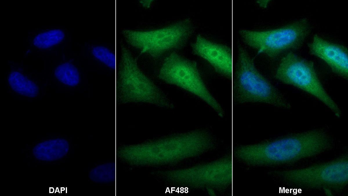 Monoclonal Antibody to Thioredoxin (Trx)