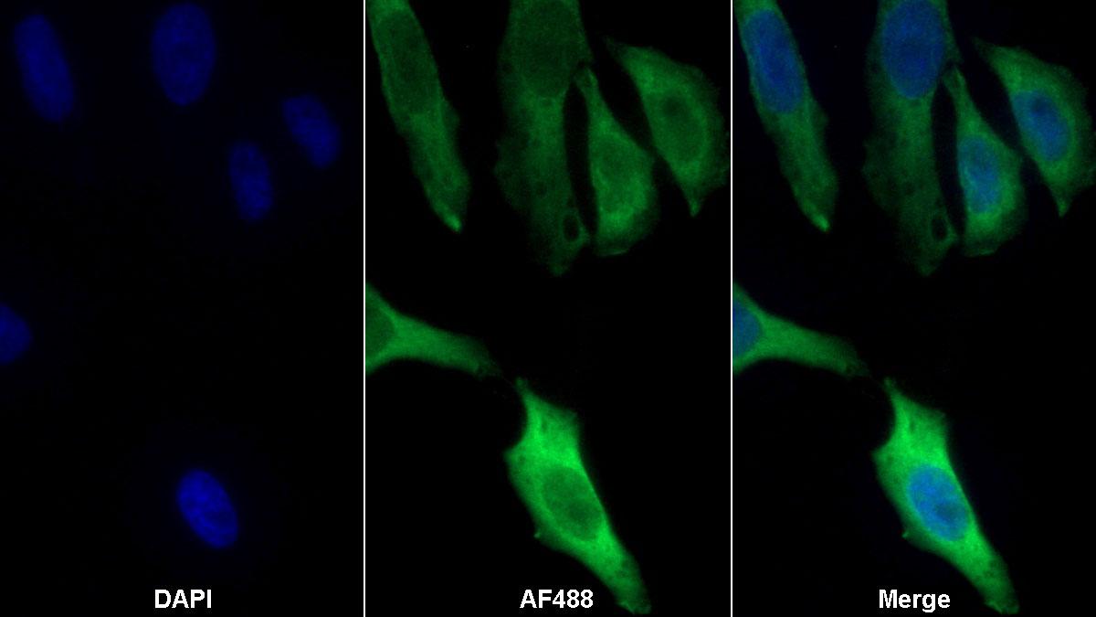 Monoclonal Antibody to Thioredoxin (Trx)