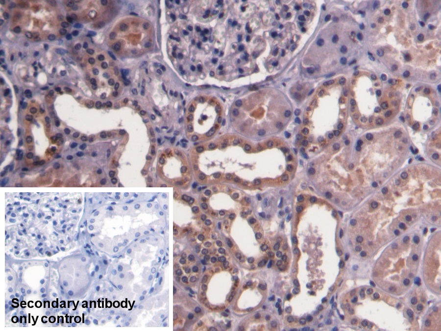 Monoclonal Antibody to Prothrombin Fragment 1+2 (F1+2)