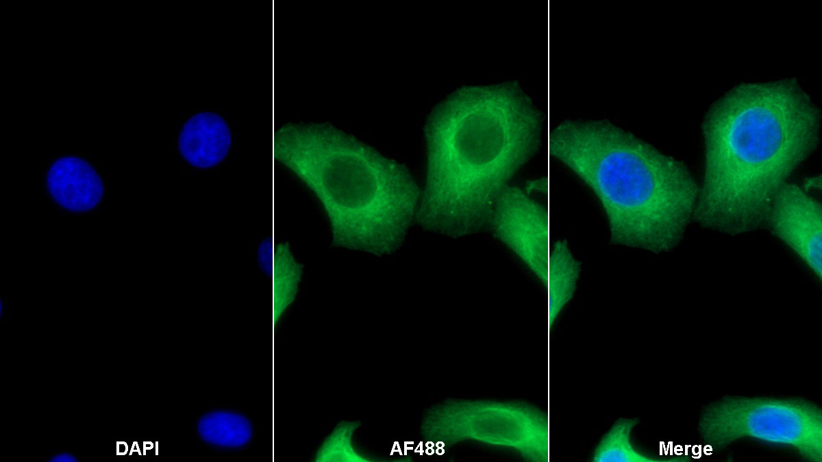 Monoclonal Antibody to Heparanase (HPSE)