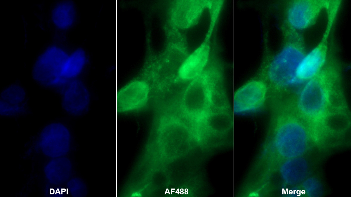 Monoclonal Antibody to Prostaglandin-H2 D-isomerase (PTGDS)