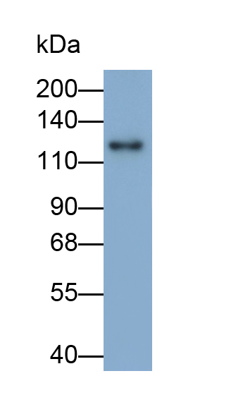 Monoclonal Antibody to Desmoglein 1 (DSG1)