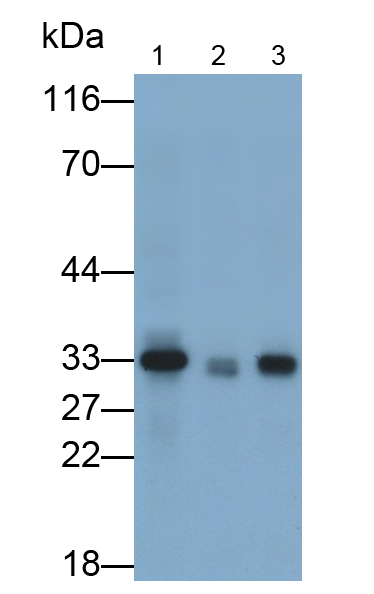 Monoclonal Antibody to Dickkopf Related Protein 1 (DKK1)
