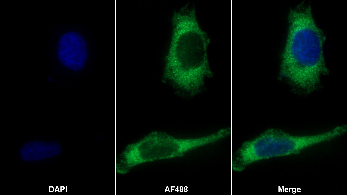 Monoclonal Antibody to Dickkopf Related Protein 1 (DKK1)