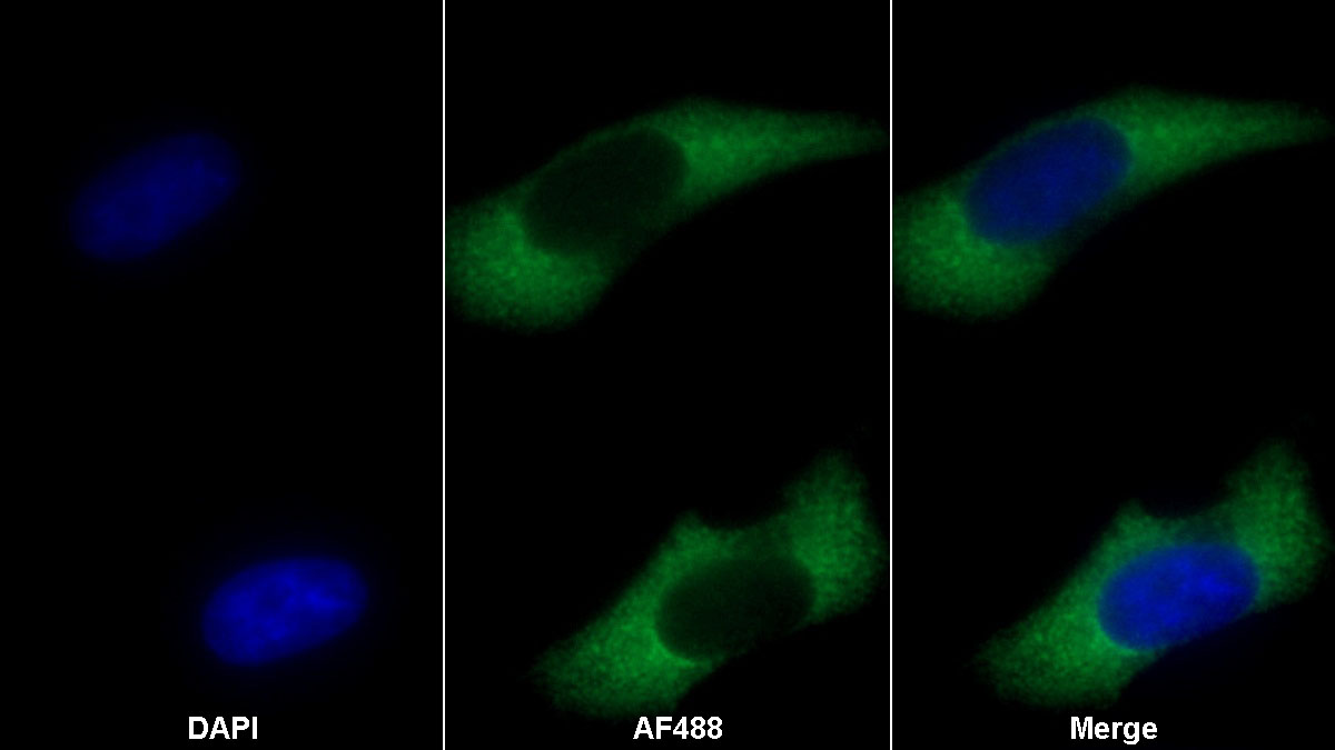 Monoclonal Antibody to Dickkopf Related Protein 1 (DKK1)