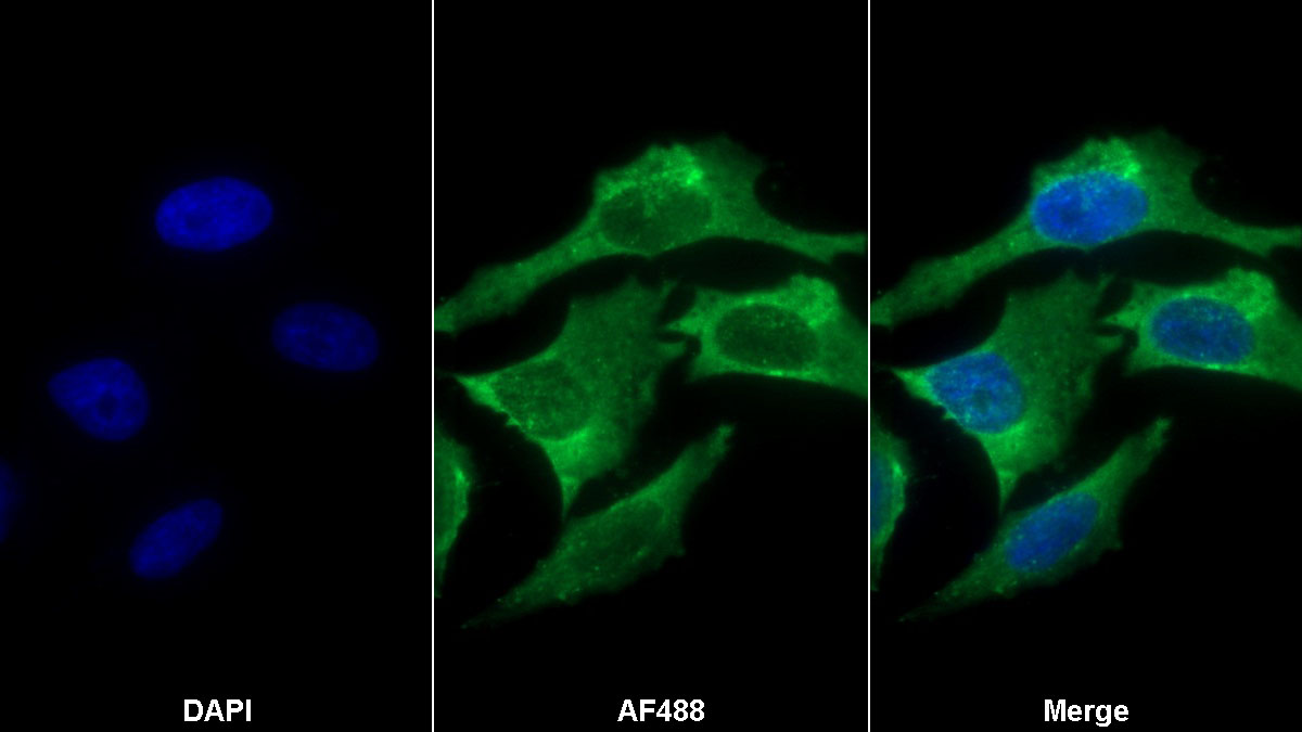 Monoclonal Antibody to Dickkopf Related Protein 1 (DKK1)