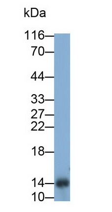 Monoclonal Antibody to Trefoil Factor 2 (TFF2)