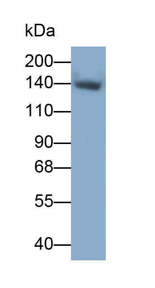 Monoclonal Antibody to Complement Receptor 2 (CD21)
