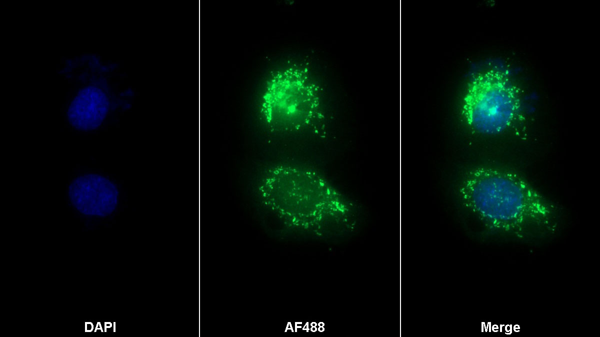 Monoclonal Antibody to Toll Like Receptor 4 (TLR4)