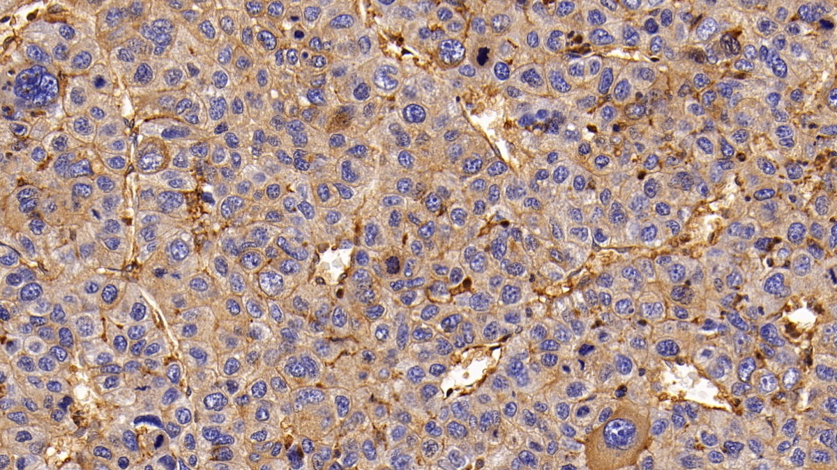 Monoclonal Antibody to Epidermal Growth Factor Receptor (EGFR)