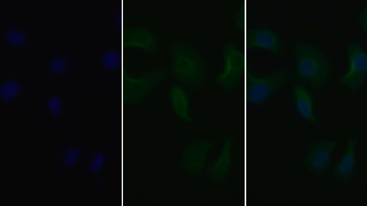 Monoclonal Antibody to Epidermal Growth Factor Receptor (EGFR)