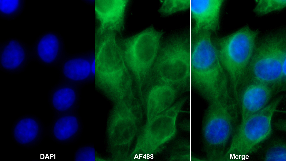 Monoclonal Antibody to Forkhead Box Protein O1 (FOXO1)