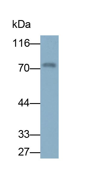 Monoclonal Antibody to Forkhead Box Protein O1 (FOXO1)