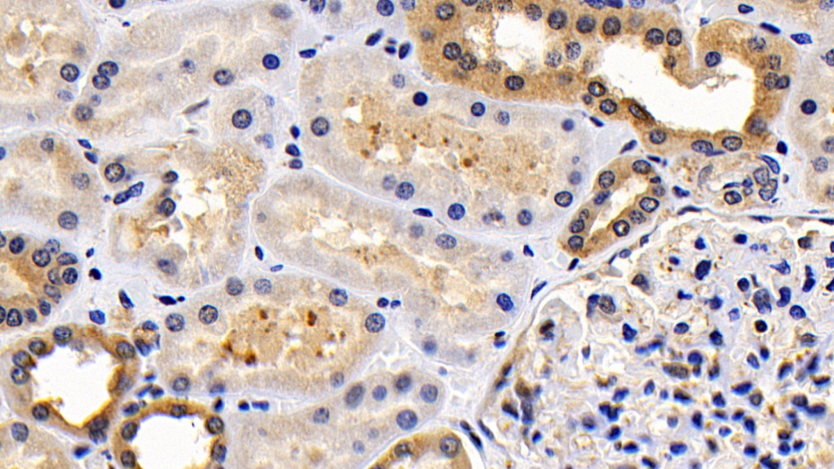 Monoclonal Antibody to B-Cell Leukemia/Lymphoma 2 (Bcl2)