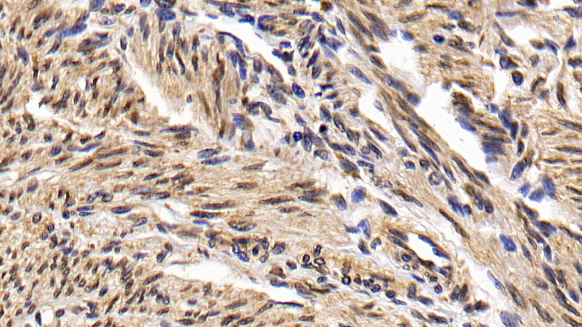 Monoclonal Antibody to B-Cell Leukemia/Lymphoma 2 (Bcl2)