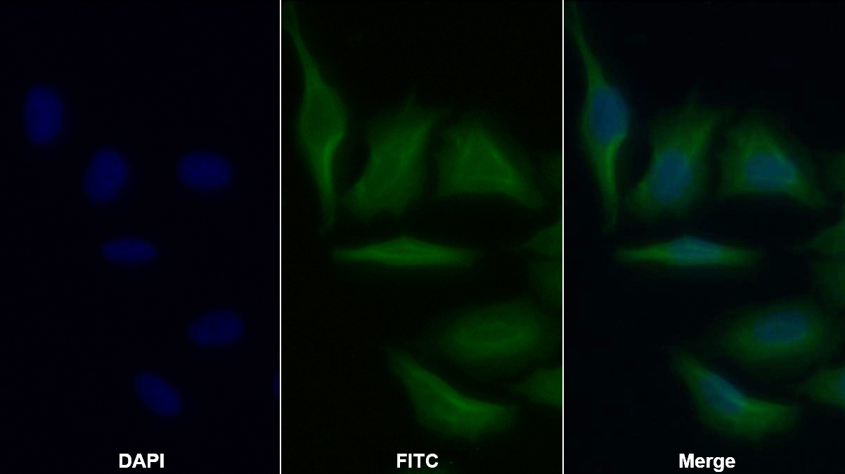 Monoclonal Antibody to B-Cell Leukemia/Lymphoma 2 (Bcl2)