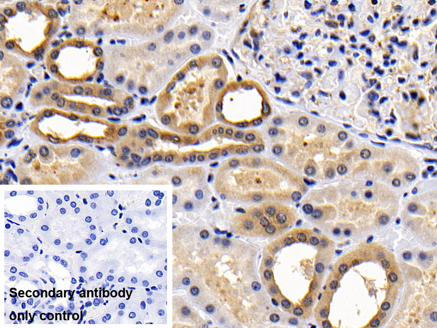 Monoclonal Antibody to B-Cell Leukemia/Lymphoma 2 (Bcl2)