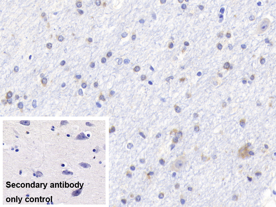 Monoclonal Antibody to B-Cell Leukemia/Lymphoma 2 (Bcl2)