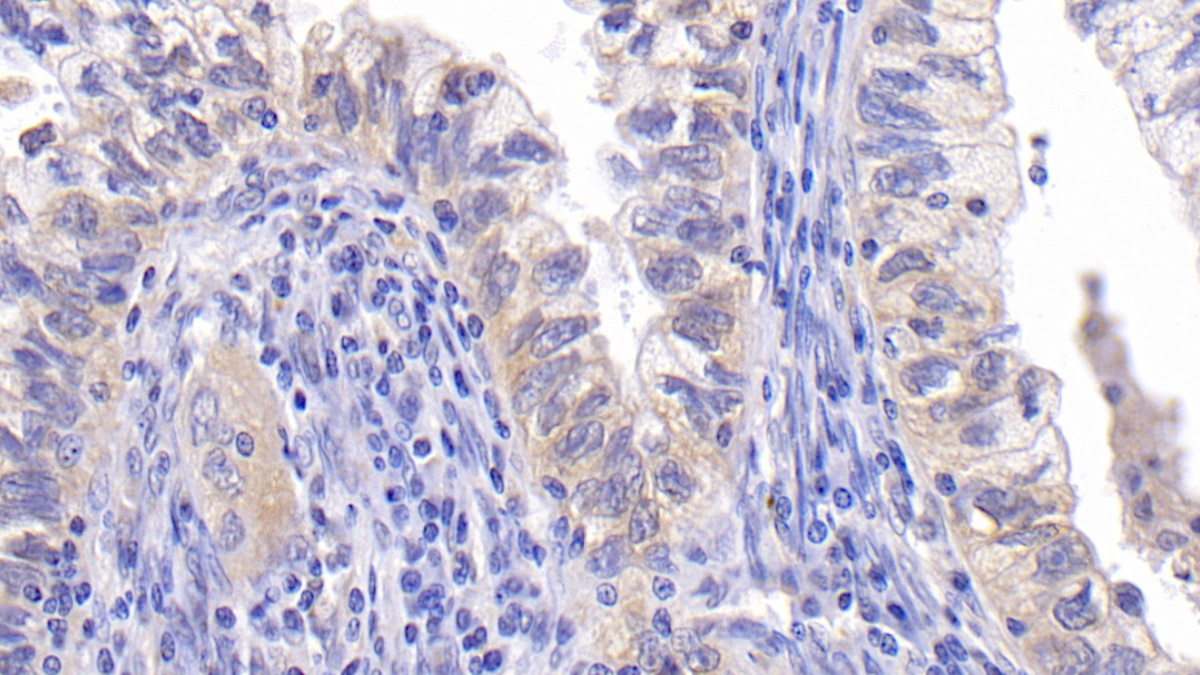 Monoclonal Antibody to B-Cell Leukemia/Lymphoma 2 (Bcl2)