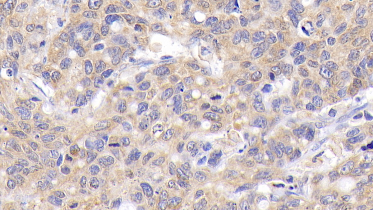 Monoclonal Antibody to B-Cell Leukemia/Lymphoma 2 (Bcl2)