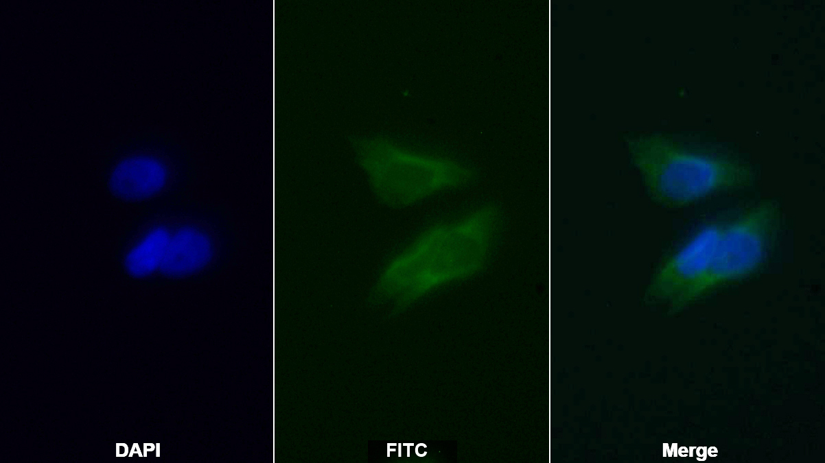 Monoclonal Antibody to B-Cell Leukemia/Lymphoma 2 (Bcl2)