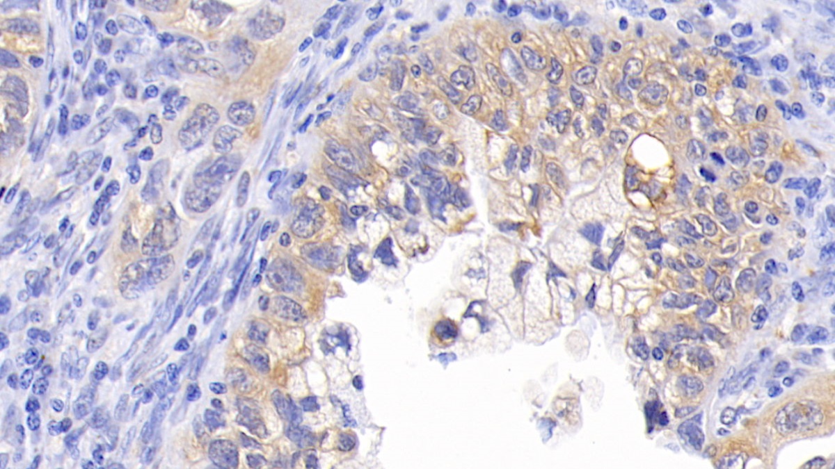 Monoclonal Antibody to B-Cell Leukemia/Lymphoma 2 (Bcl2)