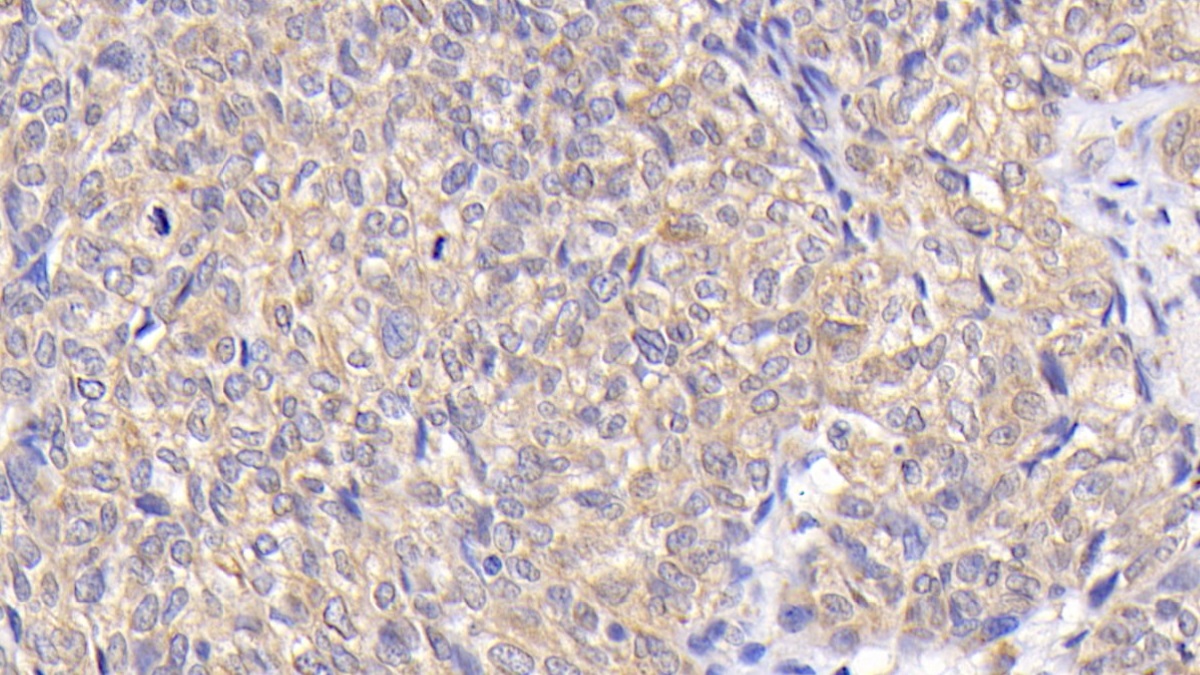 Monoclonal Antibody to B-Cell Leukemia/Lymphoma 2 (Bcl2)