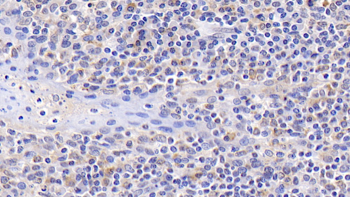 Monoclonal Antibody to B-Cell Leukemia/Lymphoma 2 (Bcl2)