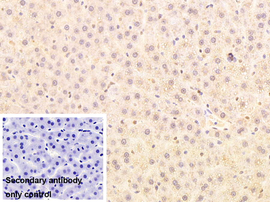 Monoclonal Antibody to Cyclin Dependent Kinase Inhibitor 2A (CDKN2A)