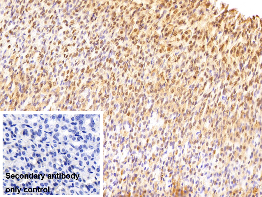 Monoclonal Antibody to Cyclin Dependent Kinase Inhibitor 2A (CDKN2A)