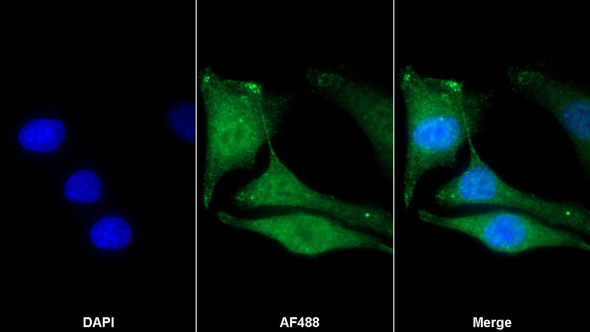 Monoclonal Antibody to Hypoxia Inducible Factor 1 Alpha (HIF1a)