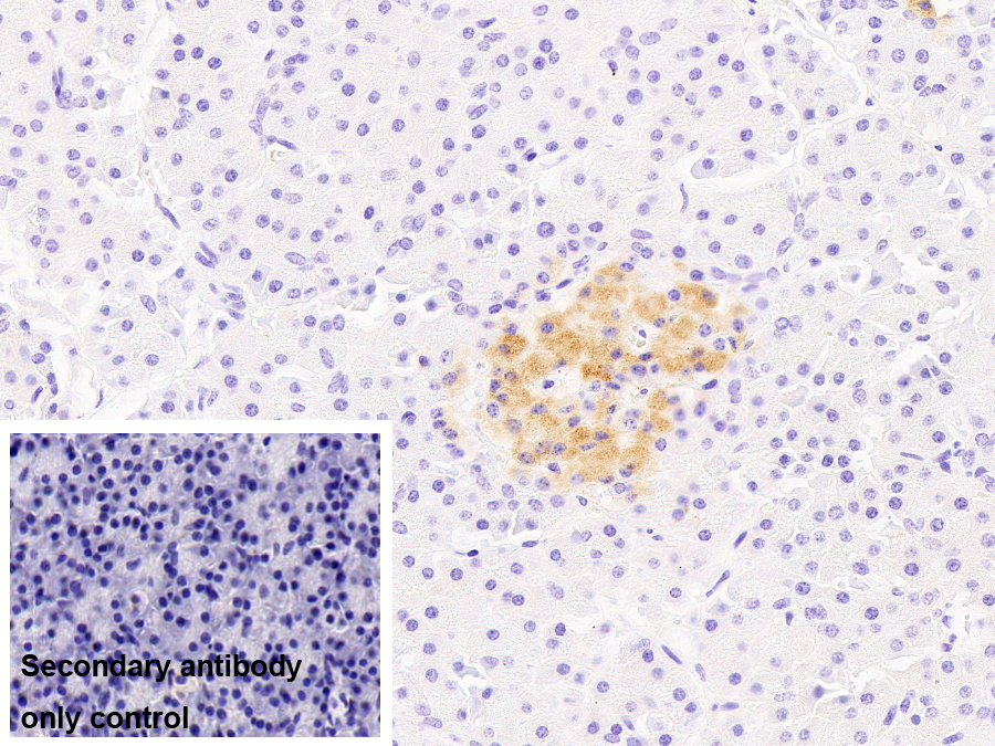 Monoclonal Antibody to Amylin
