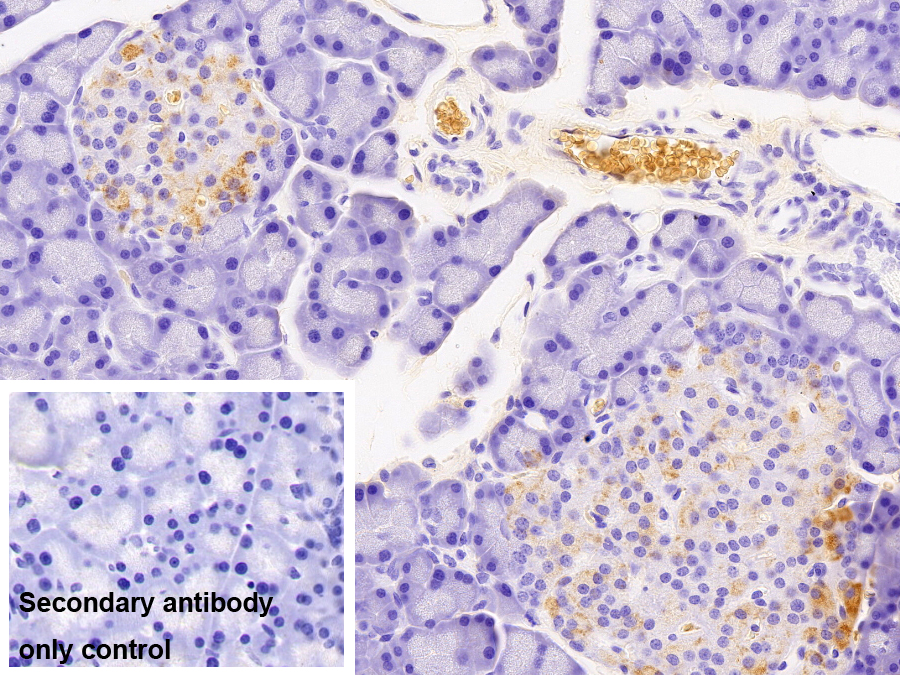 Monoclonal Antibody to Amylin
