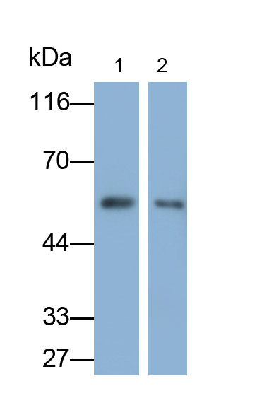 Monoclonal Antibody to Alpha-1-Acid Glycoprotein (a1AGP)