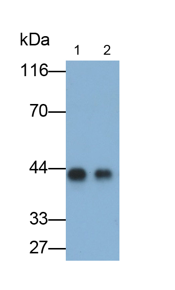 Monoclonal Antibody to Alpha-1-Acid Glycoprotein (a1AGP)