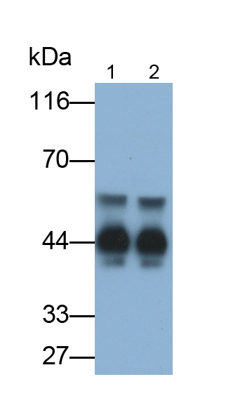 Monoclonal Antibody to Alpha-1-Acid Glycoprotein (a1AGP)