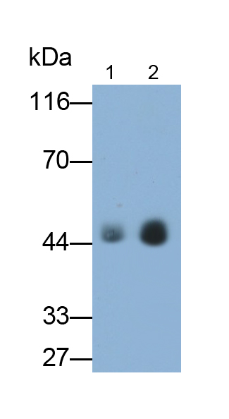 Monoclonal Antibody to Alpha-1-Acid Glycoprotein (a1AGP)